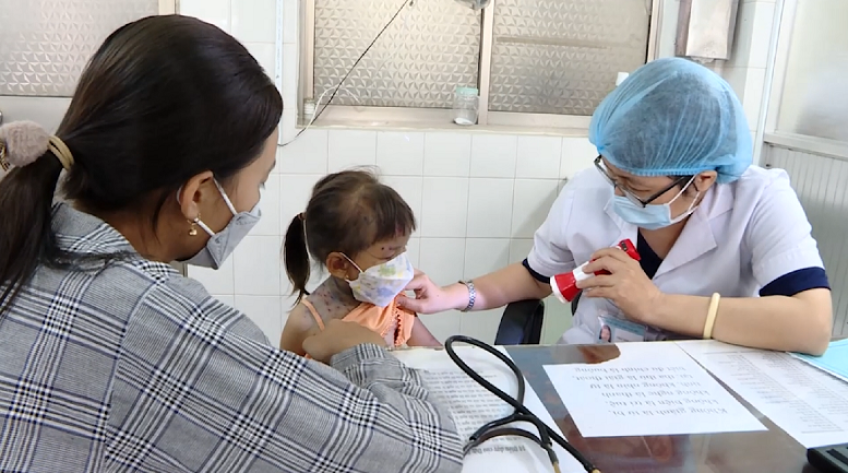 Dịch tay chân miệng: 50% nguy cơ từ phụ huynh