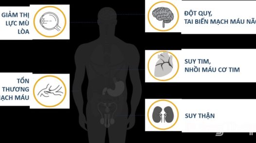 Đo huyết áp tại nhà - những điều cần lưu ý