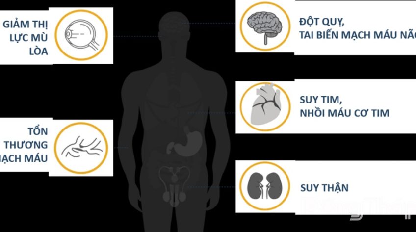 Đo huyết áp tại nhà - những điều cần lưu ý