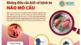 Bác sĩ gỡ 49 con ong trên đầu người phụ nữ