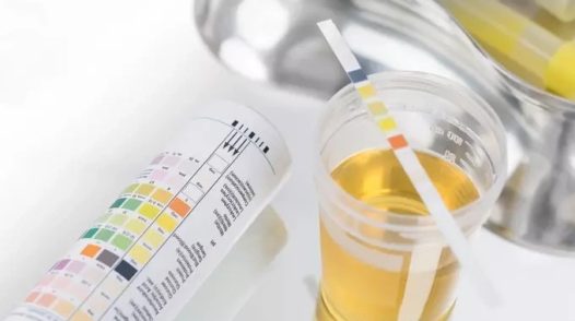 Bác sĩ cảnh báo dấu hiệu bệnh thận dễ bị bỏ qua