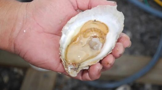 Suy thận cấp do nhiễm vi khuẩn sau ăn hàu sống