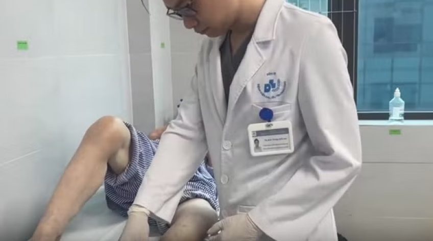 Vết loét chân kéo dài không lành có thể là dấu hiệu của bệnh lý tĩnh mạch