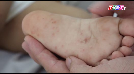 Cảnh báo nhiều bệnh truyền nhiễm đến sớm