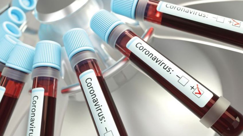 Ca tử vong thứ 22 mắc Covid-19 là bệnh nhân nam, 63 tuổi