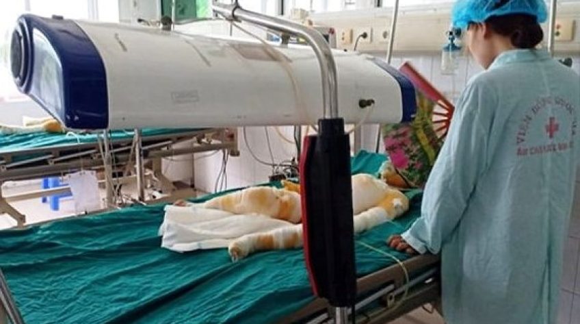 Vụ 3 trẻ bị bỏng trong giờ học kỹ năng sống về PCCC: Tai nạn xảy ra khi cô giáo đổ thêm cồn