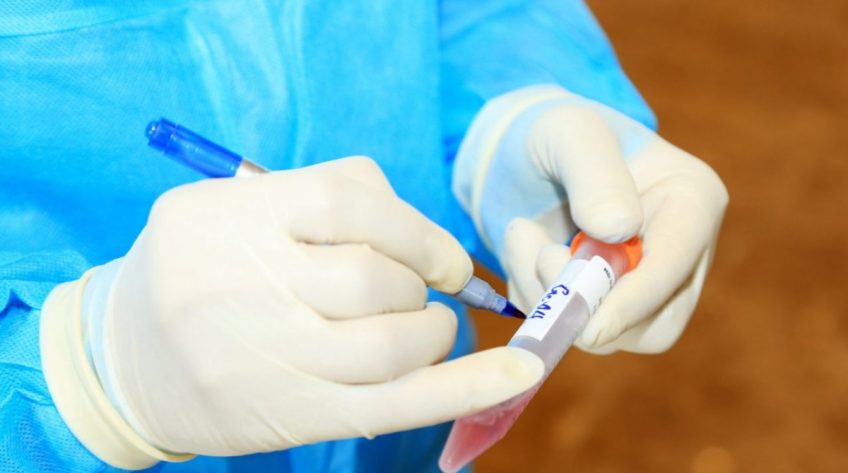 Số ca mắc COVID-19 cả nước gia tăng, nhiều F0 phát hiện qua dấu hiệu ho, sốt