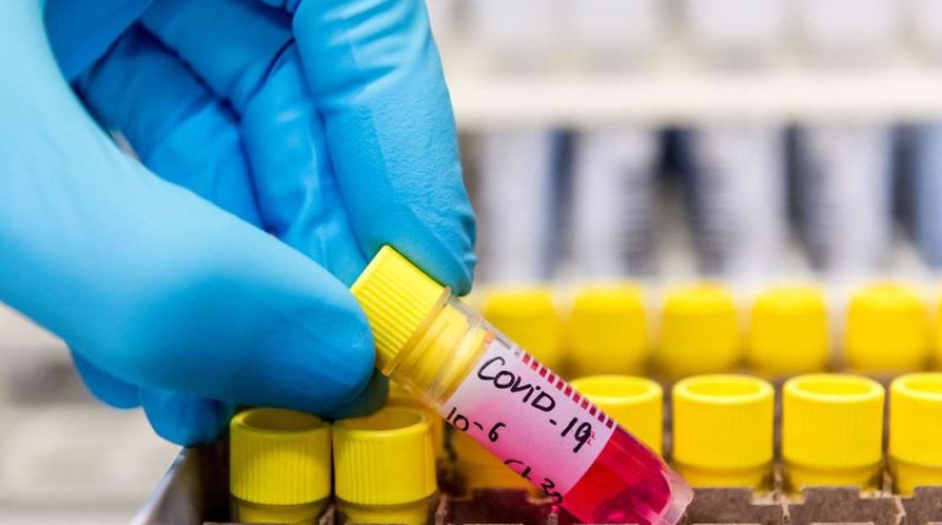 Phát hiện chủng virus SARS-CoV-2 ở Malaysia có khả năng lây nhiễm gấp 10 lần