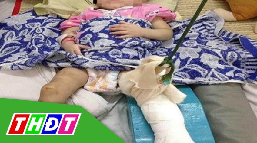 TP.HCM: Khởi tố mẹ nuôi bạo hành bé 1 tuổi